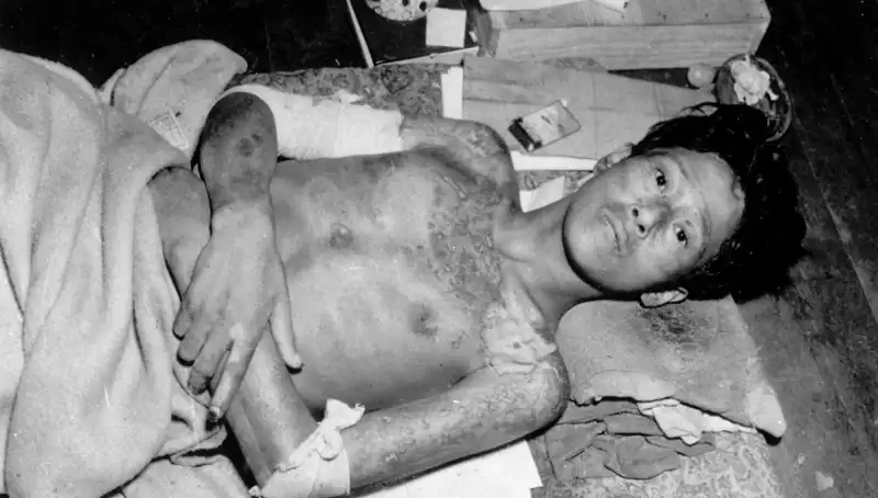 Nagasaki'den Yıllar Sonra Gelen Uyarı: Nükleer Tehdit Artıyor!